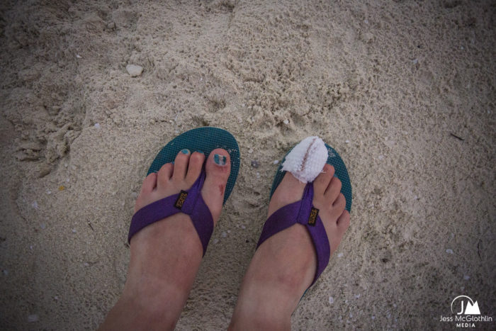 Bandaged, cut and infected feet in sandals on the beach in French Polynesia. 